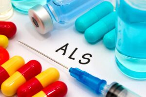 اسکلروز جانبی آمیوتروفیک(ALS)