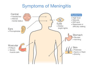 مننژیت(Meningitis)